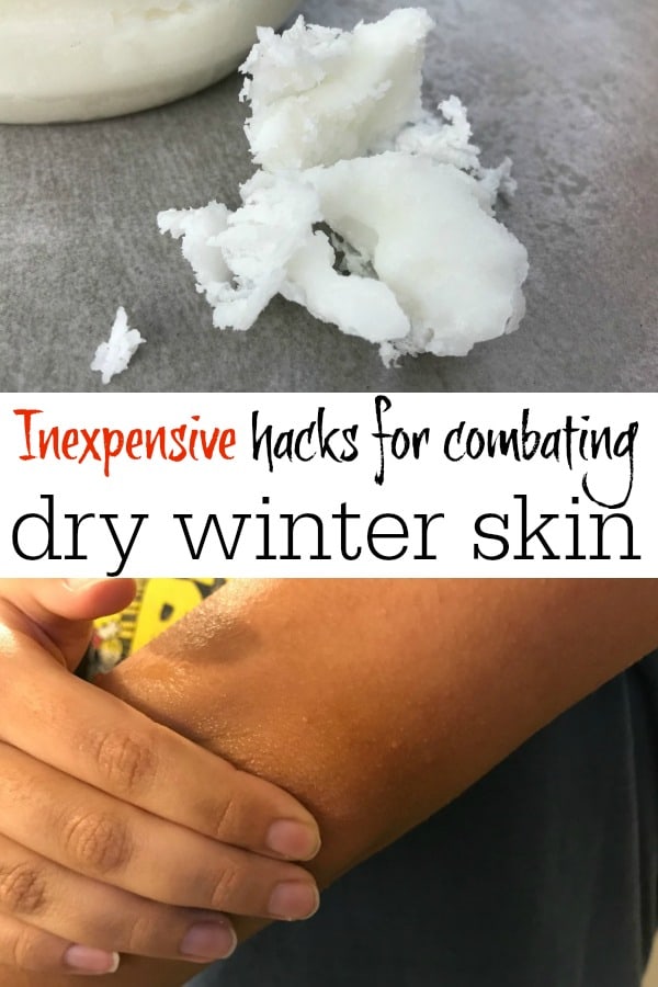 Take it from this Northern-born gal, you don't have to spend a fortune to take advantage of these super simple ways to prevent dry skin! Here's my best tips and hacks for combating itchy, flaky, dry skin.