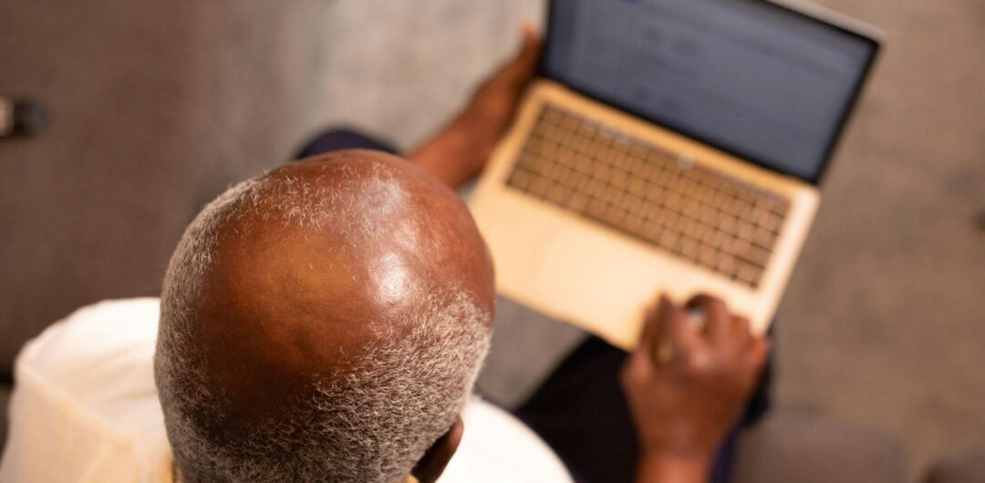 Keep Your Hair On: 7 Ways To Deal With Hair Loss 1 Keep Your Hair On: 7 Ways To Deal With Hair Loss - Man on Computer